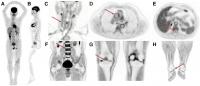 Selected Views from Total-Body Scan