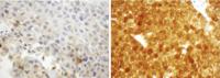 Expression of AKR1C1