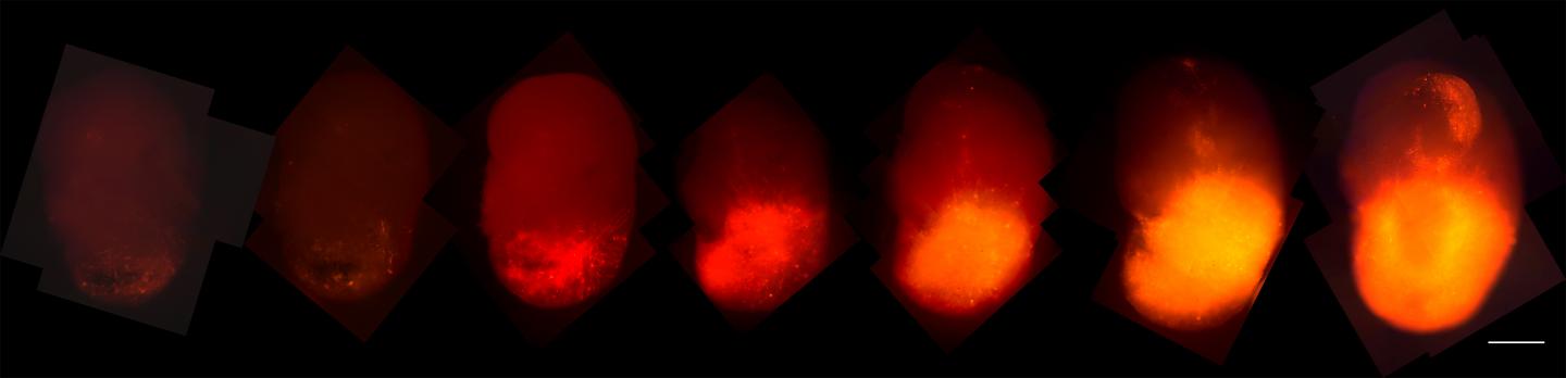 Salk Institute Organoids-Glioblastoma