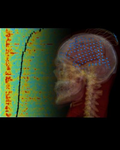 Activity in the Auditory Cortex