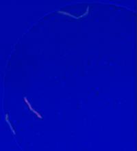 Mycobacteria Growth