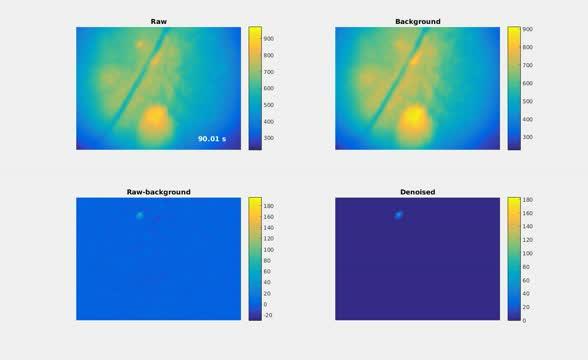 Example of Neural Activity in the Striatum During Movements