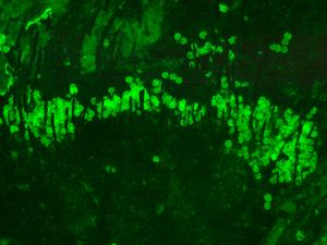 Fig. 5: Fluorescent fossil pollen on the body of the fossil bumble bee Bombus (Kronobombus) messegus (Fig. 4).