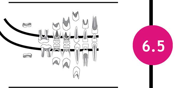 Dental Development SA Black Child Age 6.5 Years