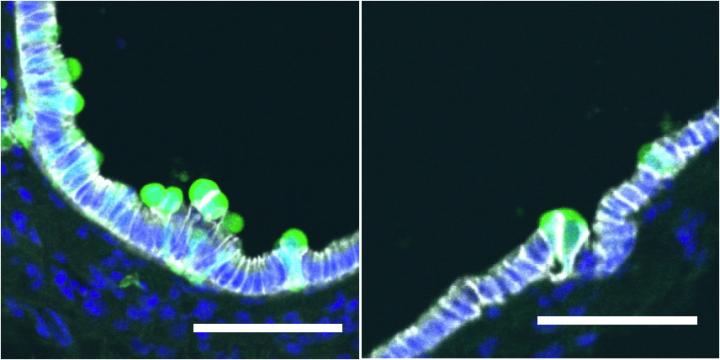 Transformed Cells in Mice Fed a Normal-Diet and a High-Fat Diet