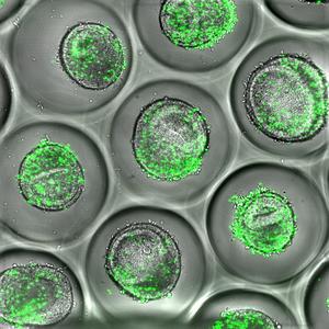 Next-Gen Liver Organoid for Predicting Drug Toxicity
