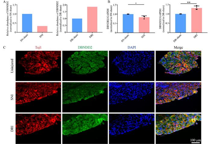 DBNDD2 is downregulated after peripheral axon injury but upregulated in adult rat DRGs after central axon injury.
