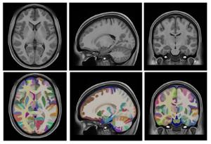 HoliAtlas Project Brain Images