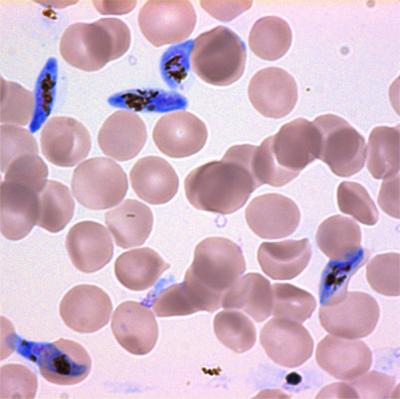 A Key Protein Is Discovered To Be Essential for Malaria Parasite Transmission to Mosquitos (1 of 2)