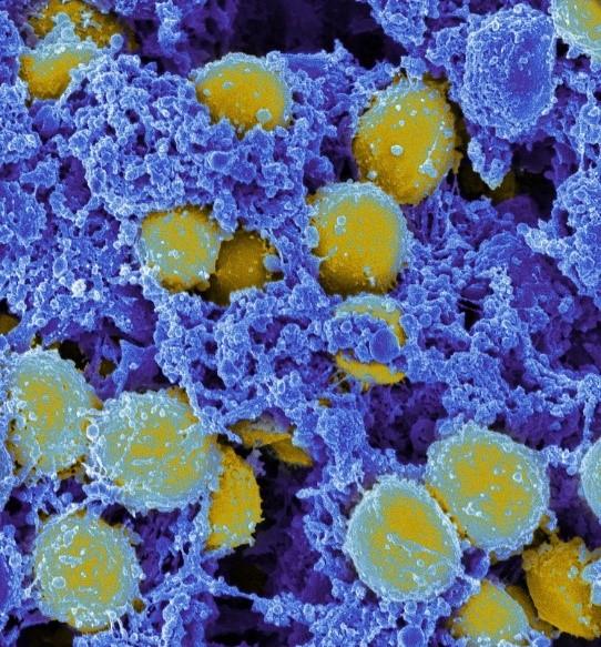 Vaccine that Harnesses Antifungal Immunity Protects Mice from Staph Infection