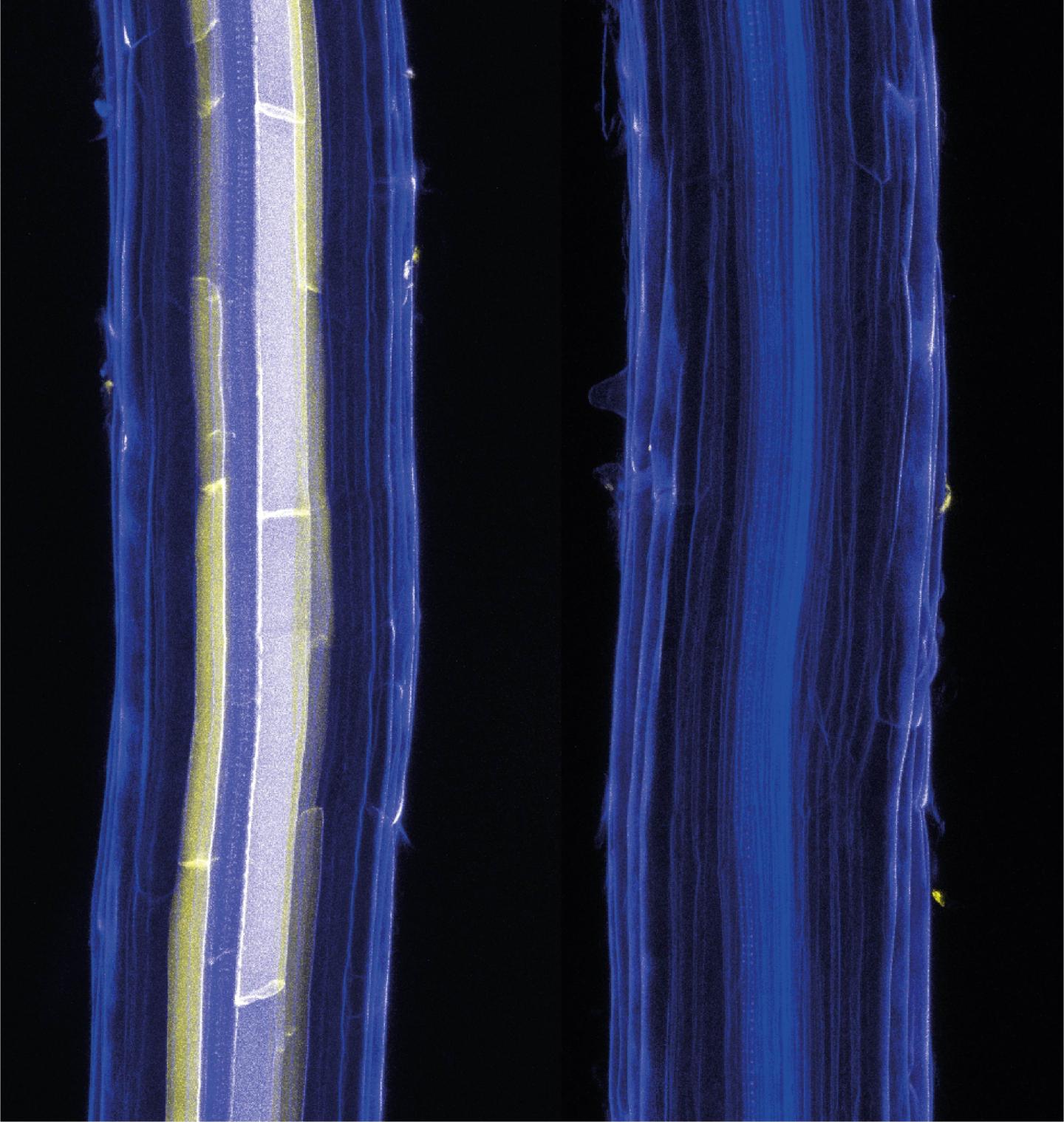 Suberin Microbiome
