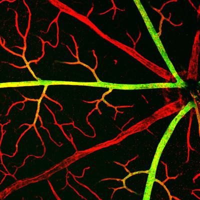 Blood Vessels of the Retina