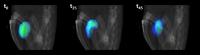 Nanorobots in the presence of urea