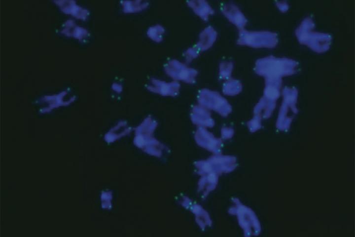 CRISPR Sheds Light on Rare Pediatric Bone Marrow Failure Syndrome