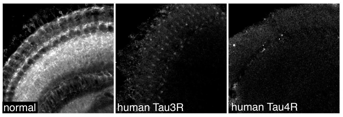 Fruit Flies Hold the Key to Understanding the Cause of Dementia