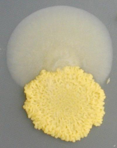 Drug Resistant 'Epimutants'