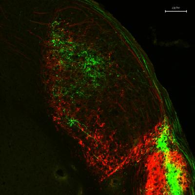 Melanopsin Looks on the Bright Side of Life (1 of 2)