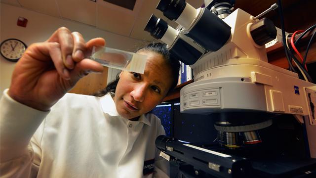 High-Fat Diet Prompts Immune Cells to Start Eating Connections between Neurons