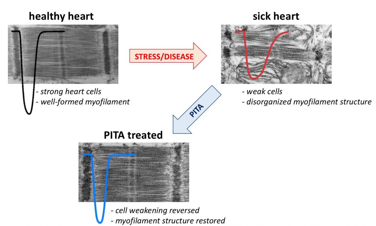 Pacemakers Skip a Beat to Treat Heart Failure (2 of 2)