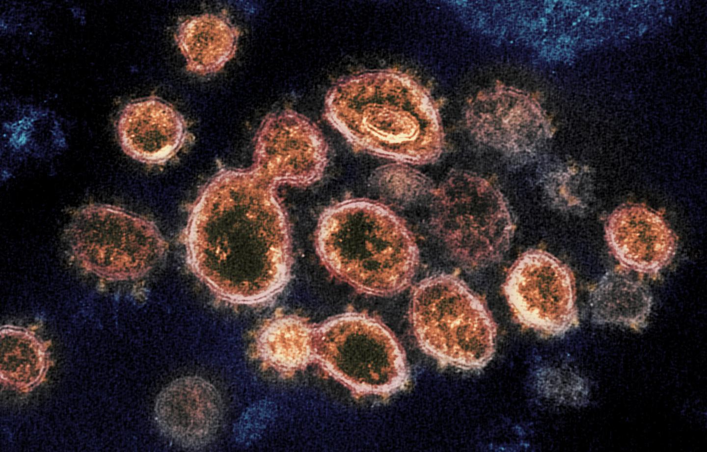 COVID-19 Virus