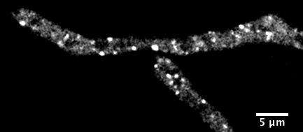 Droplets in <em>Ashbya</em> Cells