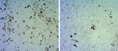 Novel Monoclonal Antibody Inhibits Tumor Growth in Breast Cancer and Angiosarcoma