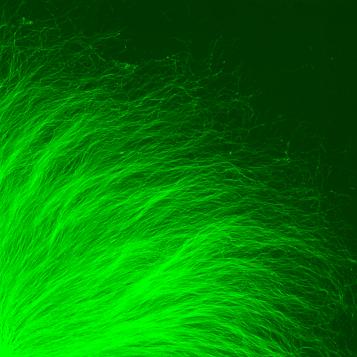 Healthy Neurons
