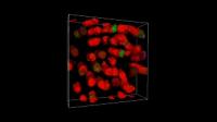 Mutant Opsin Aggregates in Rod Photoreceptor Outer Segments