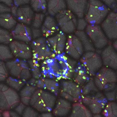 Immune Cells (or Gd T Cells) Swarm Around Fat Cells (Adipocytes) in Fat Tissue to Regulate Their Lip