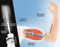 An X-ray Image and Illustration of the Mind-Controlled Prosthesis with Sensation