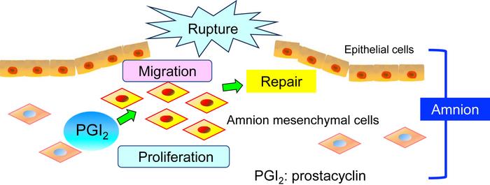 Study Uncovers Crucial Role of Prostacyclin in Fetal Membrane Healing