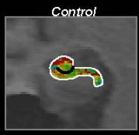 Control