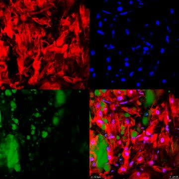 Video Showing Innovative Technique that Converts White Fat to Brown Fat