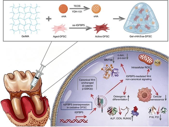 Engineered Hydrogel Helps Rejuvenate Stem Cells for Periodontal Repair