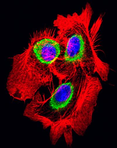 Activity of a Tumour Suppressor in Skin Cells