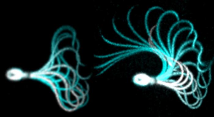 Human sperm cell