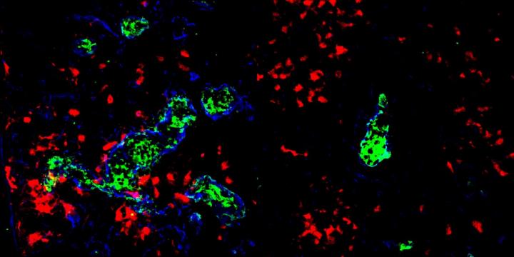 Dendritic Cells