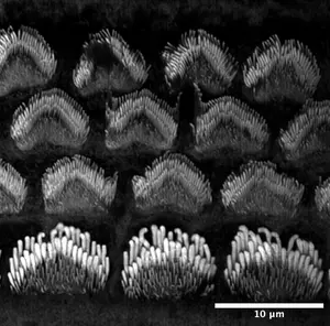 Sensory Hair Cells of the Inner Ear