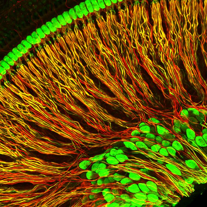 Spiral Ganglion Neurons