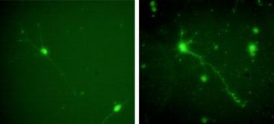 Neuron Growth