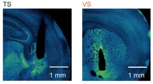 Tail of striatum and ventral striatum