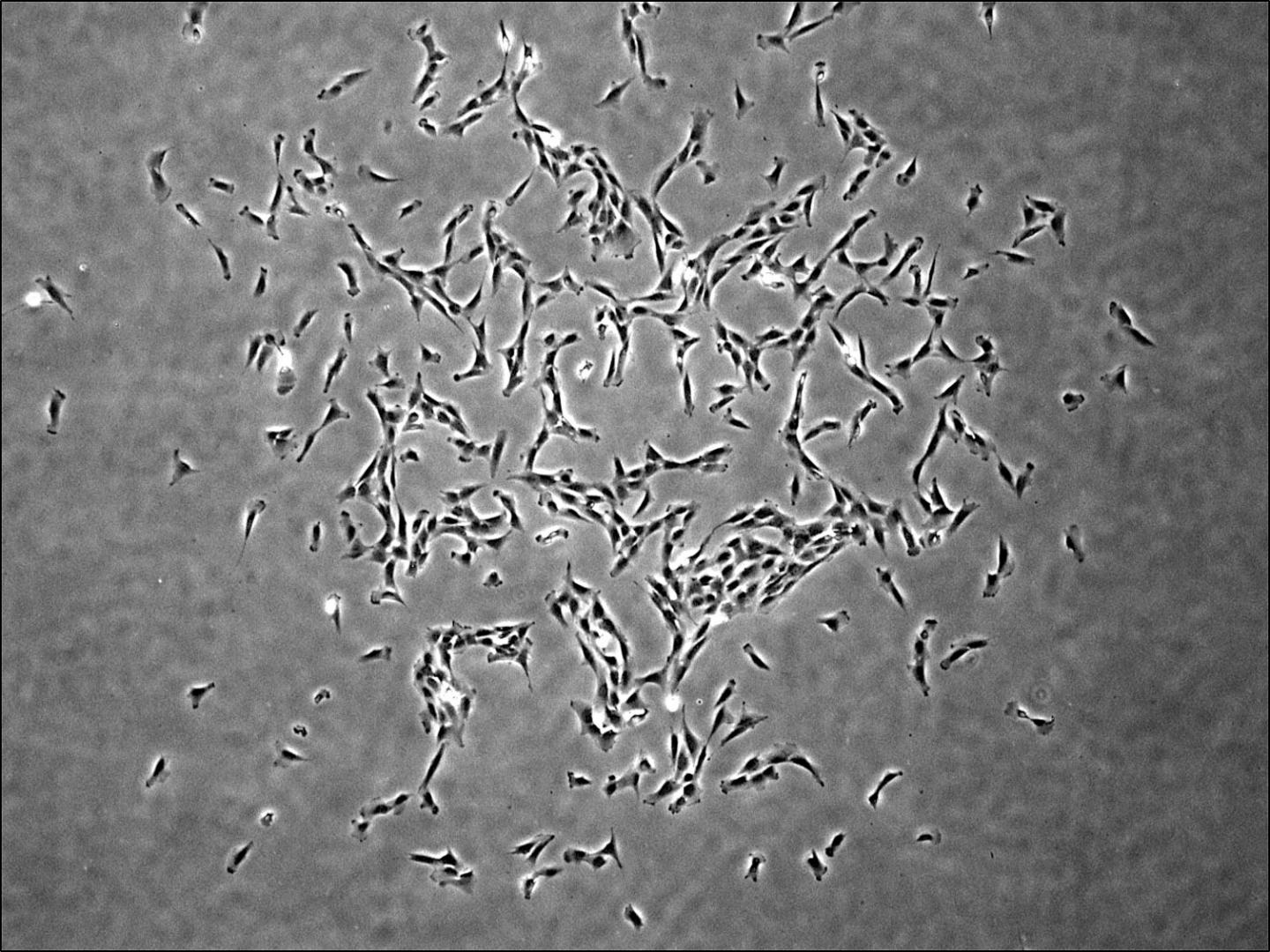 Colony Derived from a Single Human Skeletal Stem Cell