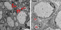 Axons & Glia