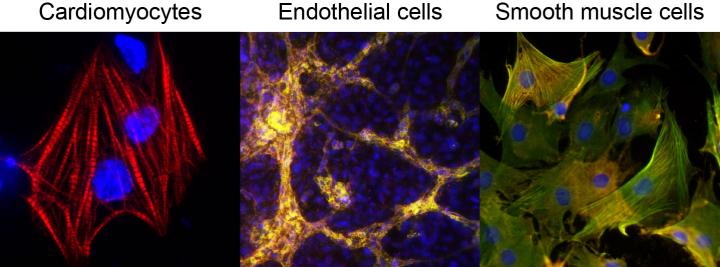Three Types of Heart Cells Created from ieCPCs
