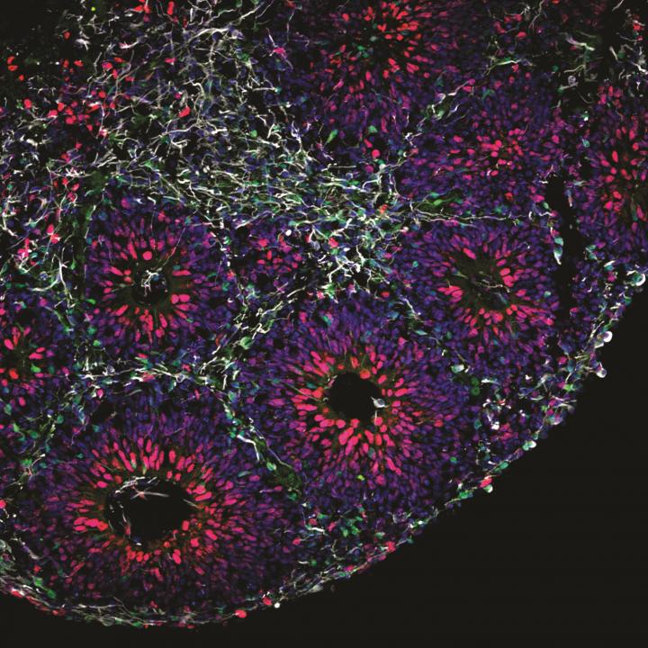 Cross-Section of a Brain Organoid