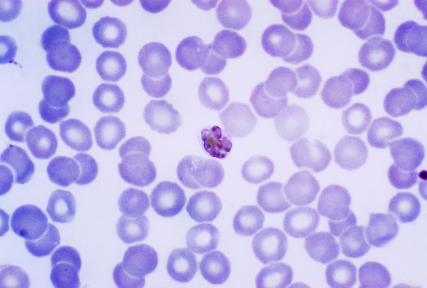 <i>Plasmodium malariae schizont</i>