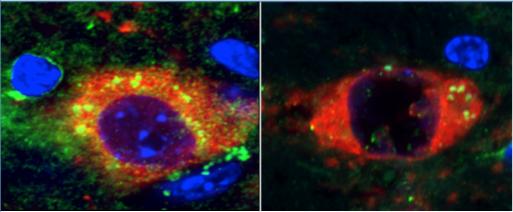 Rapamycin Prevents PD in Mouse Model of Disease