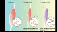 Mitofusin 2 and Muscle Aging