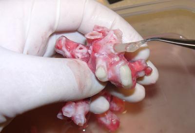 Cystic Fibrosis Pigs Get Lung Disease