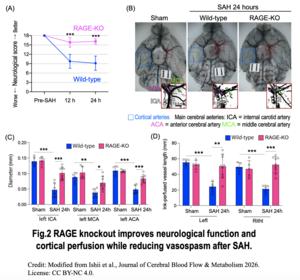 Figure 2. RAGE knockout improves neurological function and cortical perfusion while reducing vasospasm after SAH